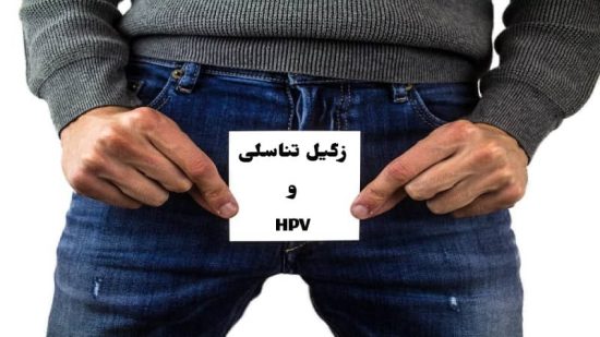 درمان زگیل تناسلی با لیزر و کرایو